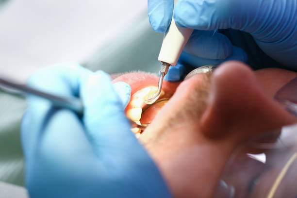 Best Weekend Emergency Dentist in Gnadenhutten, OH