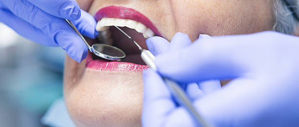 Best Urgent Care for Lost Fillings or Crowns in Gnadenhutten, OH
